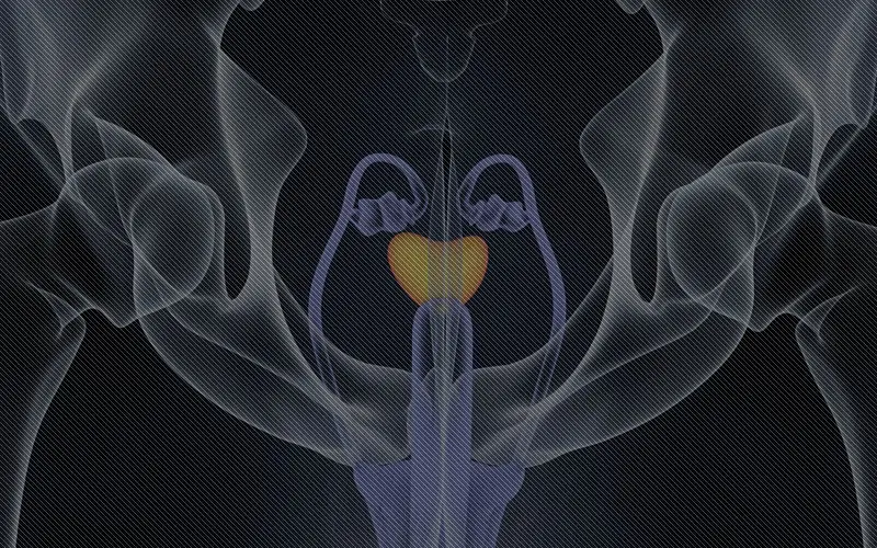 BPH Enlarge Prostate